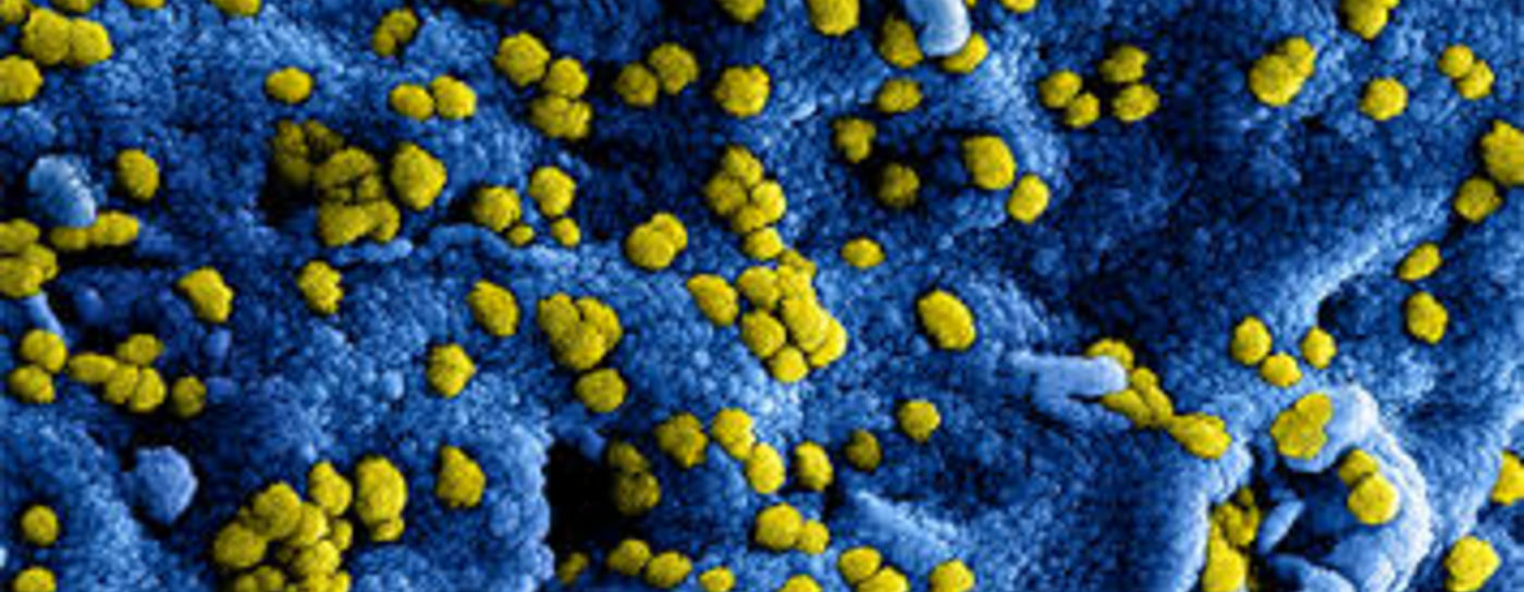 Coronavirus COVID-19